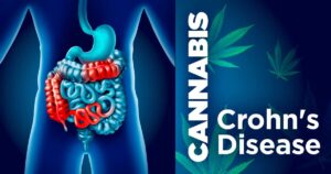 Cannabis and crohns disease. Benefits.